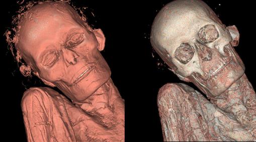 Momia Guanche