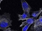 Células de cáncer de próstata