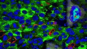 La expresión de AMPK (en verde) es muy elevada en el glioblastoma