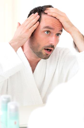 El 42% de los hombres españoles sufren alopecia