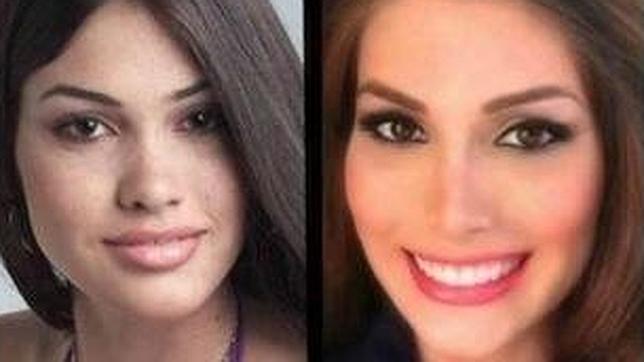 Miss Universo 13 Podria Haberse Operado La Nariz