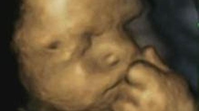 Así es la cara de un bebé en el útero cuando nota a su madre estresada