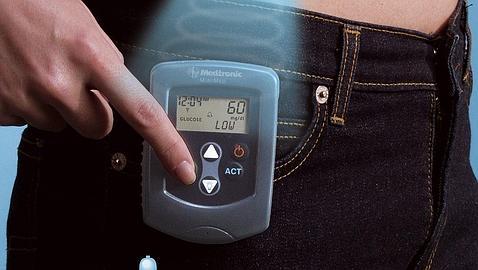 Las mejores bombas de insulina para la diabetes tipo 1