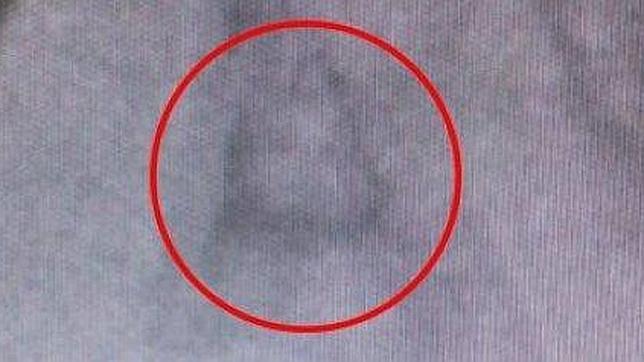 Imagen cedida por Kym Ackerman de la radiografía dental