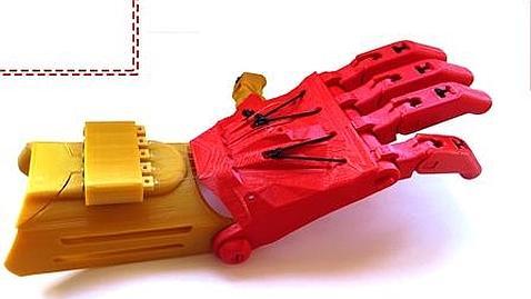 La prótesis hecha con tecnología de impresión 3D en Madrid
