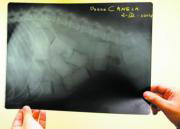 Ocurrió el 2 de abril de 2004. La Guardia Civil descubría dos perros «boleros». En vez de hacerles tragar la droga, les habían introducido las bellotas perforándoles el estómago. Esta es la radiografía de «Canela», bautizada así por los funcionarios debido a su color.
