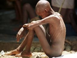 Un niño refugiado ruandés, desnutrido y hambriento, sentado desnudo, en un campo de refugiados. / ARCHIVO