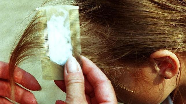 Diez consejos para que los piojos no le amarguen la vida a tu hijo