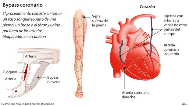 arterias y venas piernas arterias y venas piernas