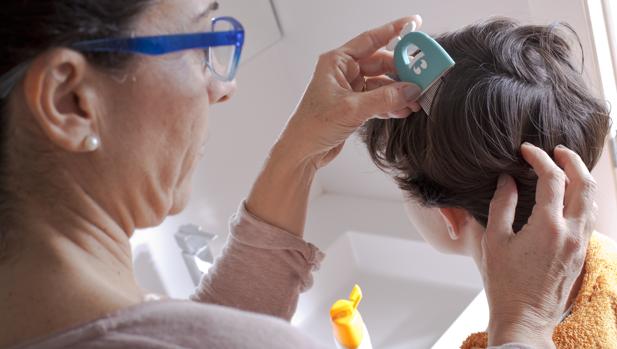 piojos en niño de 3 meses piojos en niño de 3 meses