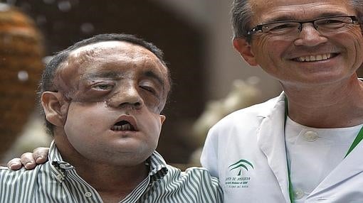 Rafael, primer trasplantado deestructura facial en Andalucía, junto al director de la Unidad de Gestión Clínica de Cirugía Plástica y Grandes Quemados del Hospital Univeristario Virgen del Rocío