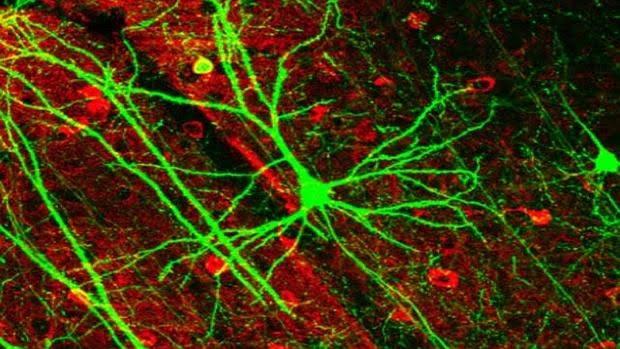 Neuronas