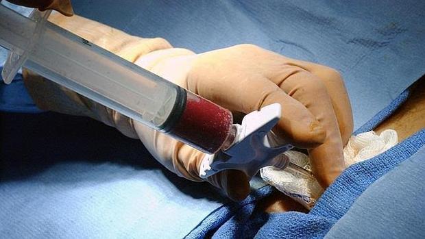 Extracción de médula ósea de un donante para para trasplante