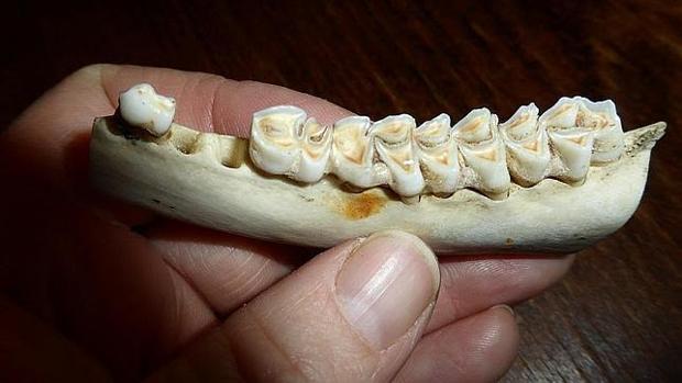 Endodoncia antes y despues de adelgazar
