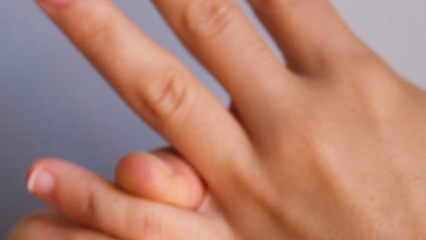 dedo hinchado de la mano por golpe dedo hinchado de la mano por golpe