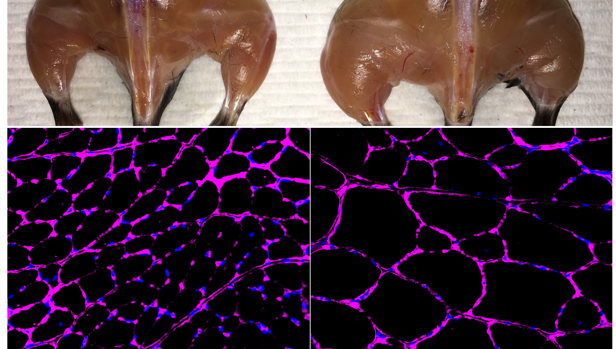 El sistema avanzado de activación del gen epigenético basado en Cas9 in vivo Belmonte mejora la masa muscular esquelética (arriba) y el crecimiento del tamaño de la fibra (parte inferior) en un ratón tratado (derecha) en comparación con un control independiente (izquierda). Las imágenes de microscopía fluorescente en la parte inferior muestran la tinción púrpura de la glicoproteína laminina en las fibras musculares tibiales anteriores.