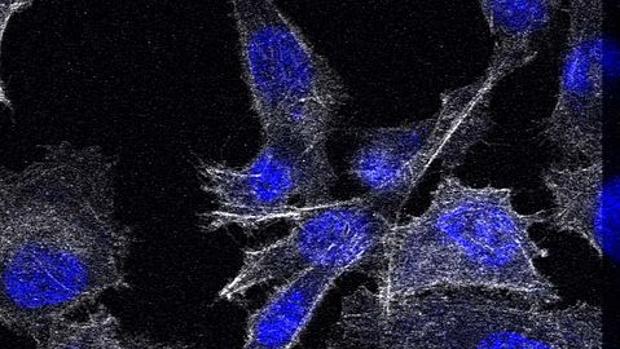 terapia metastásica para el cáncer de próstata 3