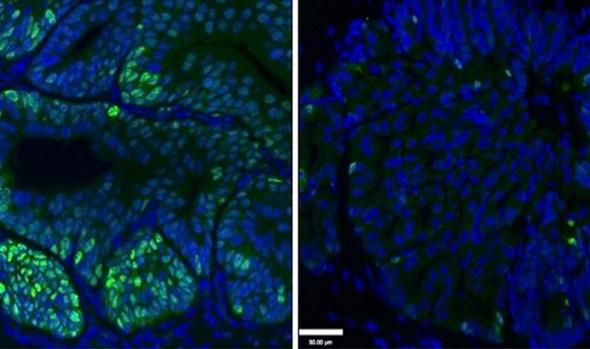 Eliminacion de células de cáncer de próstata (en verde) con el tratamiento con deguelina (derecha)