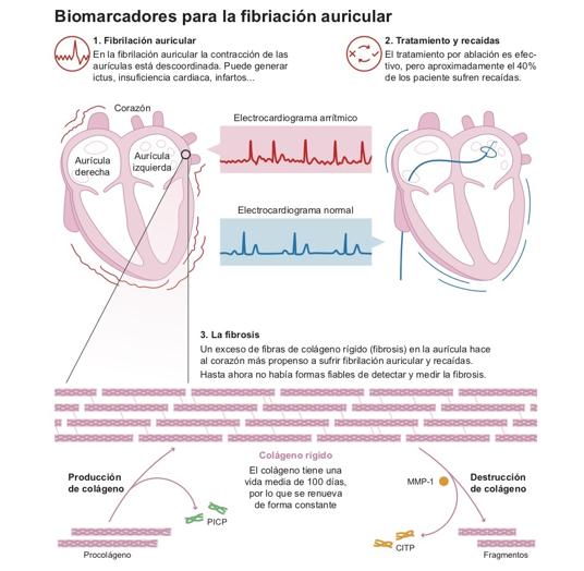 Biomarcadores para la fibriación auricular
