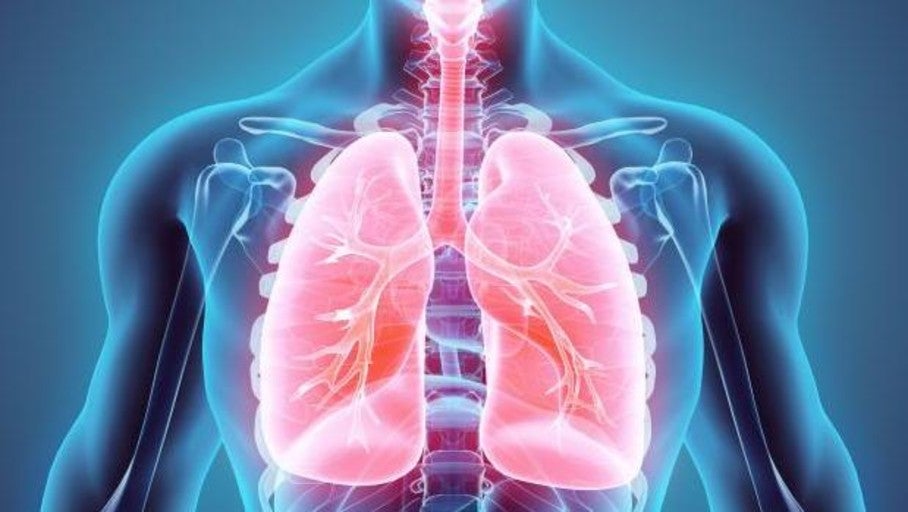 PharmaMar solicitará en EE.UU. el registro de un nuevo fármaco contra el cáncer de pulmón microcítico