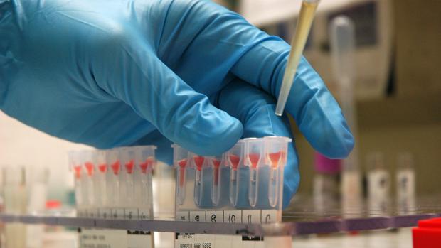 examen de sangre detecta el cancer