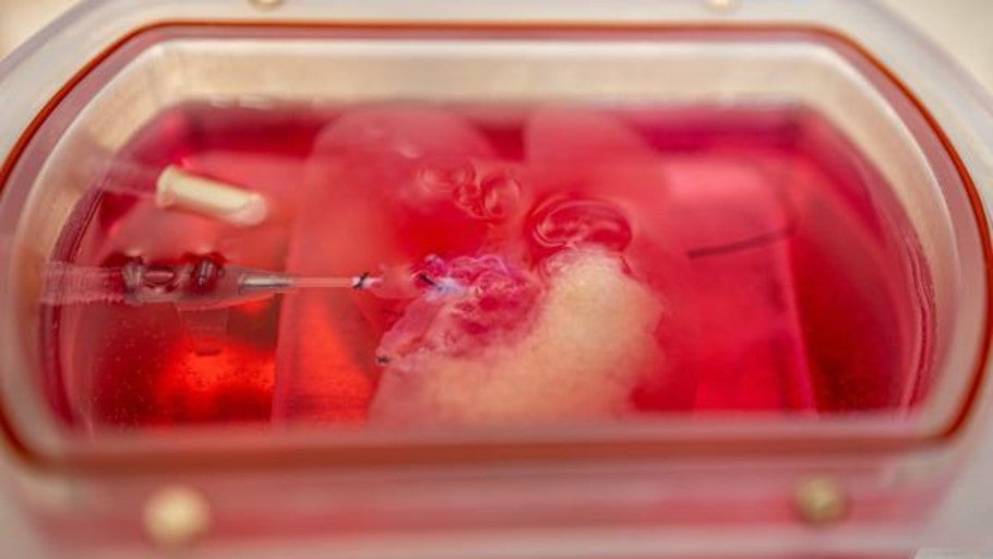 Nuevo método de enfriado que triplica el tiempo de conservación de un hígado donado