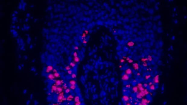 Fosfo-histona H3 (rojo) y tinciÃ³n de nÃºcleos celulares (azul) en un folÃ­culo piloso humano tratado con Taxotere (docetaxel). Las cÃ©lulas en rojo no pueden dividirse adecuadamente despuÃ©s del tratamiento de quimioterapia.