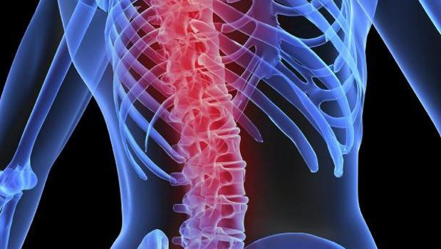 Guia de practica clinica osteoporosis 2020
