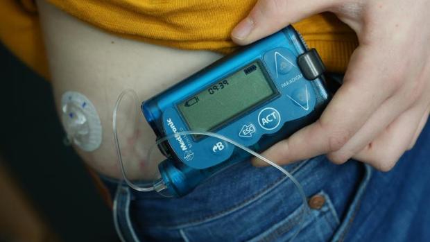diabetes de las uñas infectadas