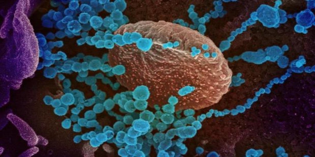 Coronavirus: Sanidad autoriza a Pharmamar a probar su tratamiento contra el Covid-19 en pacientes