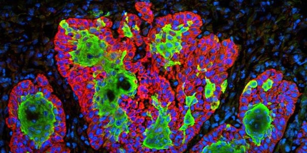 El reloj biológico, una diana objetiva inesperada para tratar el cáncer de próstata
