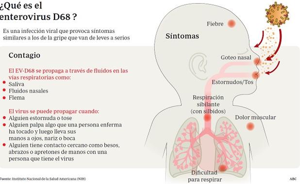 La gripe viral es contagiosa