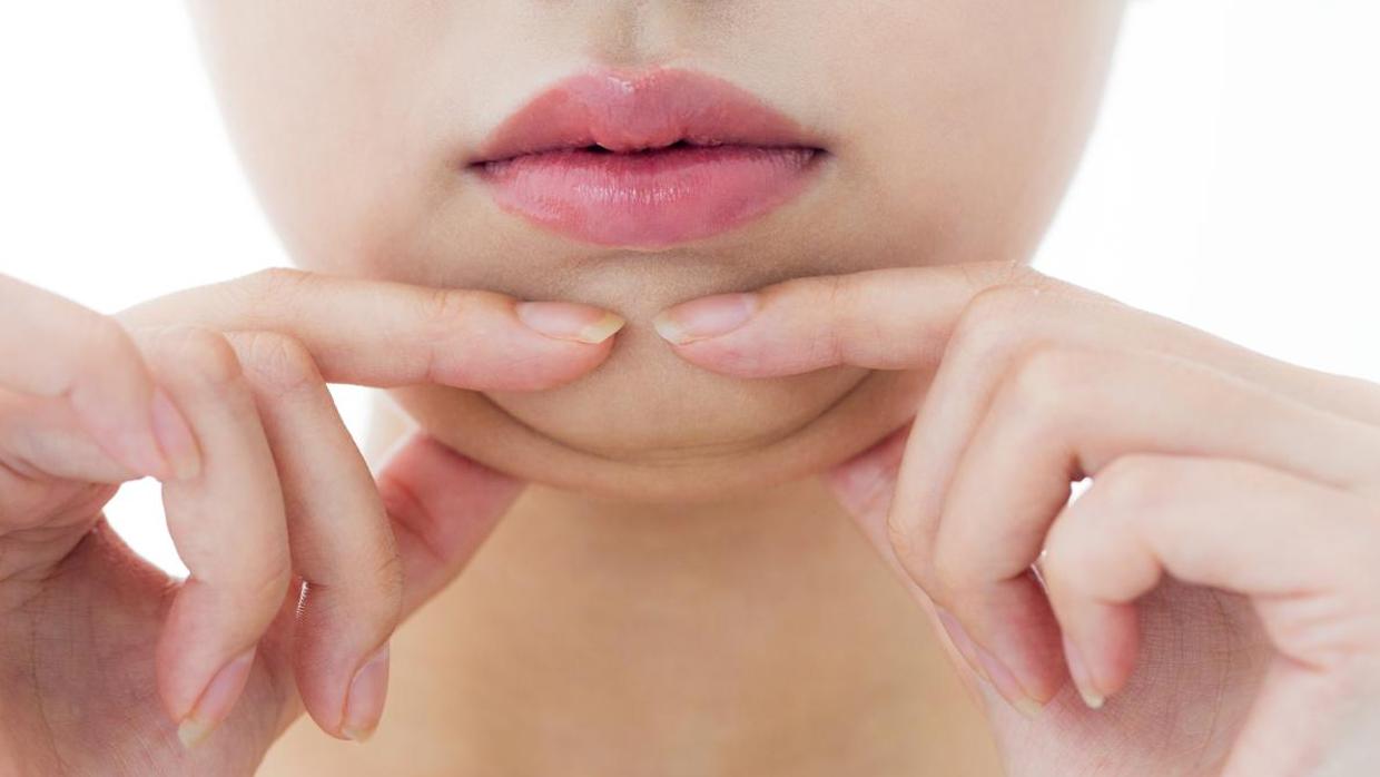 adelgazamiento facial y lipo de papada sin cirugia
