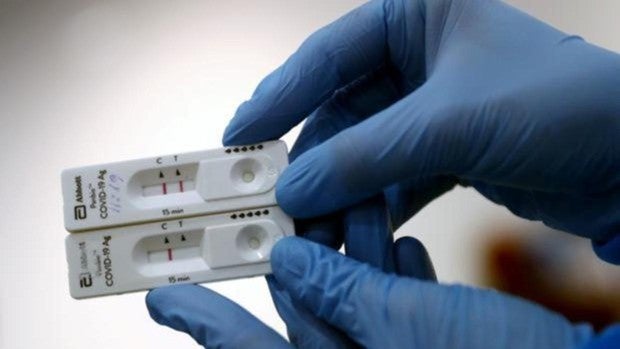 Test Elisa: qué son, cómo funcionan y qué precio tienen